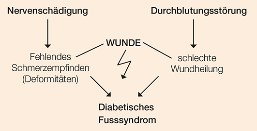 Diabetisches Fusssyndrom Erklaerung