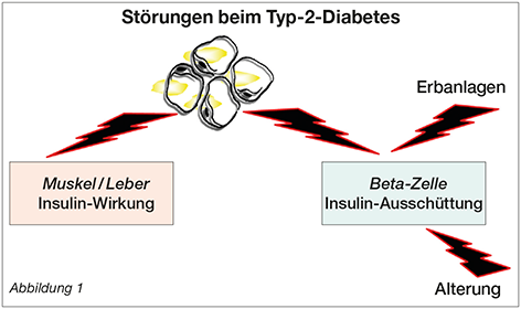 Tabelle Metabolische Chirurgie Stoerungen beim Typ-2-Diabetes